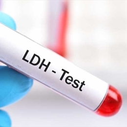 LDH (Laktat Dehidrogenaz) Nedir? & Ne İşe Yarar?
