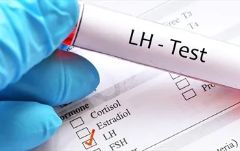 LH nedir, hangi durumlarda test edilir?