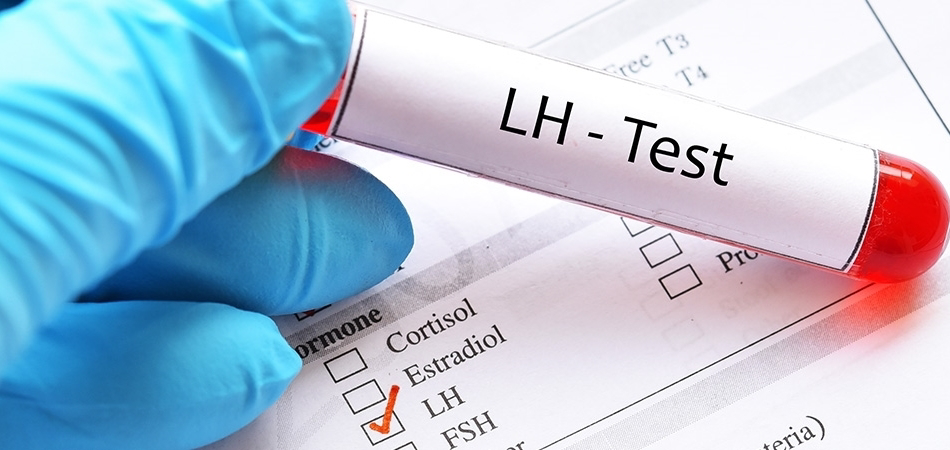LH nedir, hangi durumlarda test edilir?