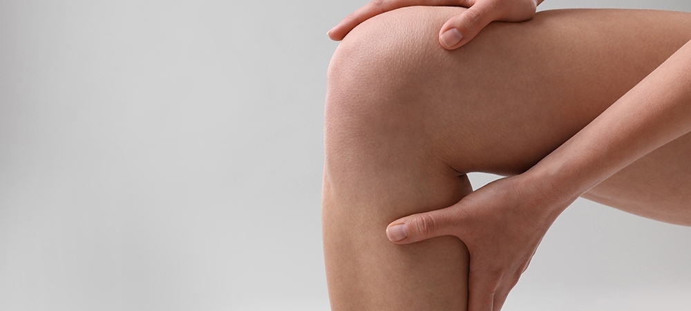 Lipödem (ağrılı selülit) nedir?