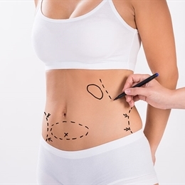 Liposuction Nedir, Liposuction ile Ne Hedeflenir?