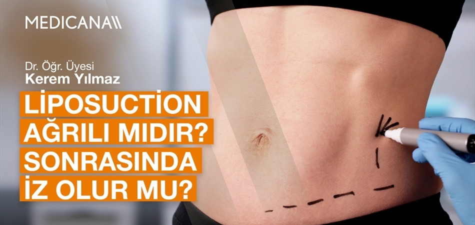 Liposuction Ağrılı mıdır? Sonrasında İz Olur mu?