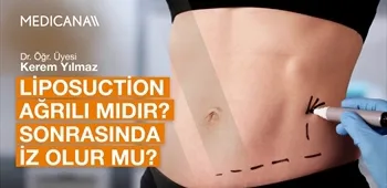 Liposuction Ağrılı mıdır? Sonrasında İz Olur mu?