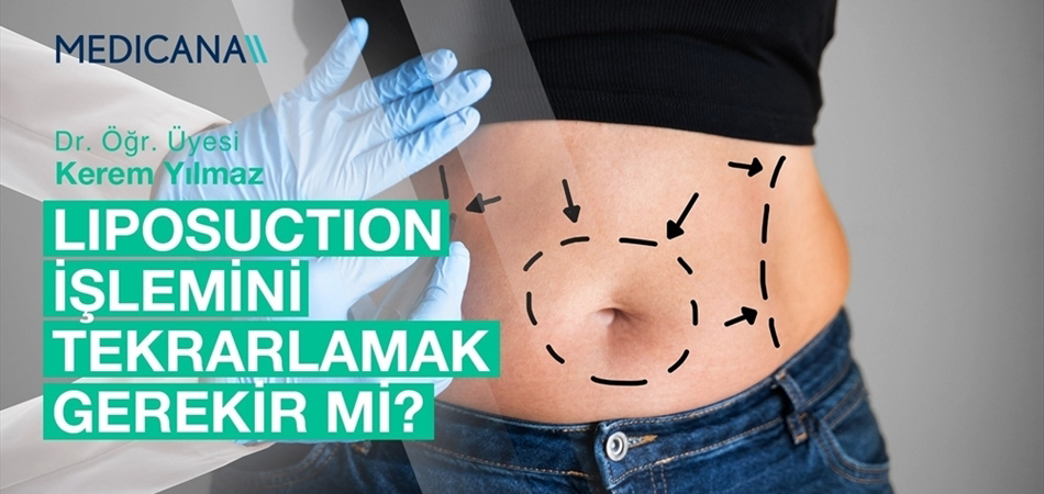 Liposuction İşlemini Tekrarlamak Gerekir mi?