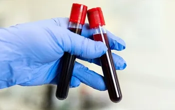 LY tahlili nedir? LY değeri kaç olmalı?