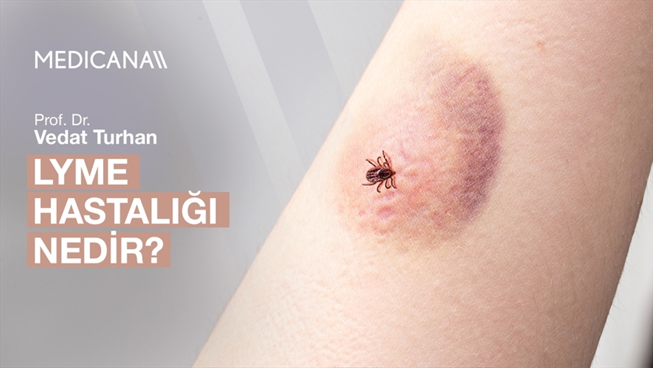 Lyme Hastalığı Nedir?