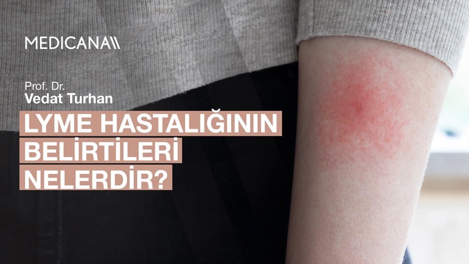 Lyme Hastalığının Belirtileri Nelerdir?