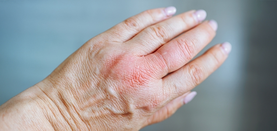 Makrodaktili ne demek? Makrodaktili neden olur?