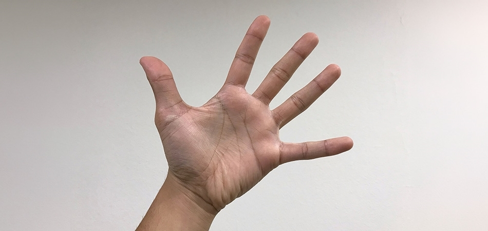Marfan sendromu nedir? Belirtileri, tanısı ve kardiyovasküler riskleri