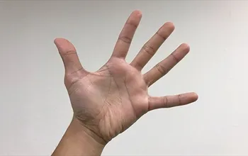 Marfan sendromu nedir? Belirtileri, tanısı ve kardiyovasküler riskleri