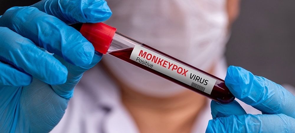 Maymun çiçeği virüsü (monkeypox) nedir? Maymun çiçeğinin belirtileri nelerdir?