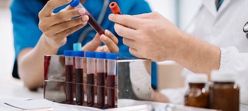 MCH düşüklüğü/yüksekliği nedir? MCH yüksekliği/düşüklüğü neden olur?