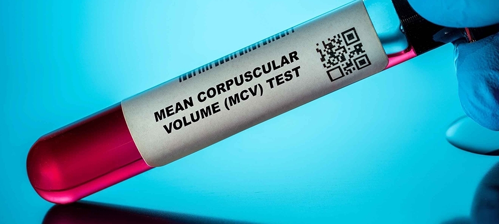 MCV ne anlama gelir? MCV düşüklüğü için hangi vitamin kullanılır?