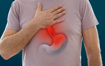 Mide ekşimesi: Nedenleri, belirtileri ve tedavi süreci