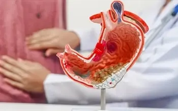 Mide kanaması belirtileri nelerdir? Mide kanaması tedavisi