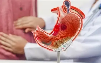 Mide kanseri belirtileri nelerdir? Mide kanseri belirtileri, evreleri ve tedavisi...