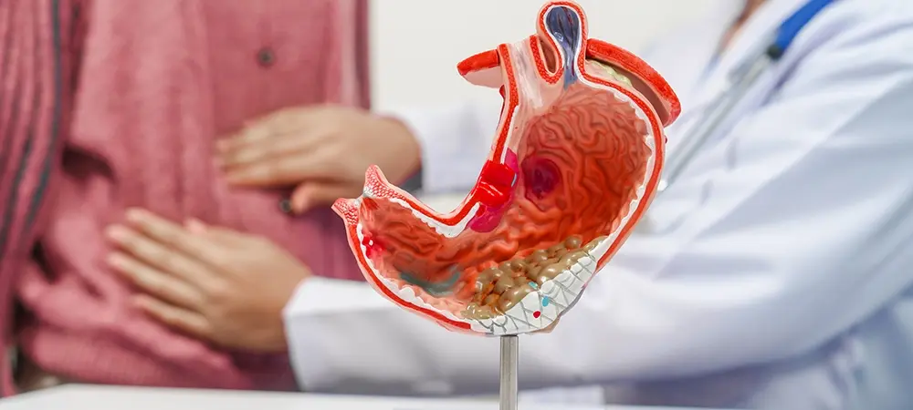 Mide kanseri belirtileri nelerdir? Mide kanseri evreleri ve tedavi süreci Mide kanseri belirtileri nelerdir? Mide kanseri evreleri ve tedavi süreci