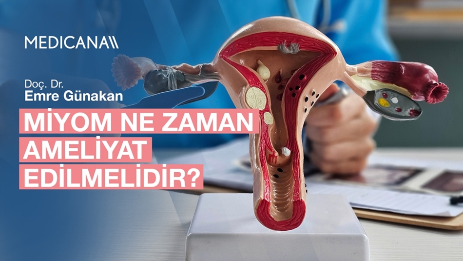 Miyom Ne Zaman Ameliyat Edilmelidir?