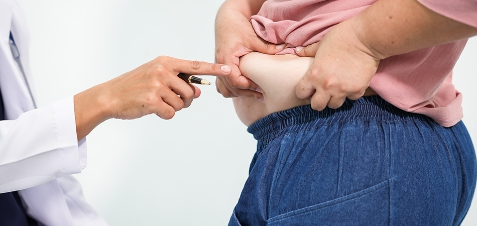 Obezite nasıl teşhis edilir? Obezite nelere sebep olur?