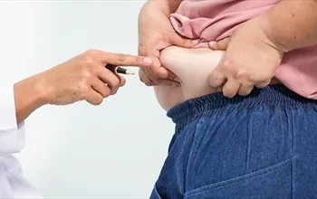 Obezite nasıl teşhis edilir? Obezite nelere sebep olur?