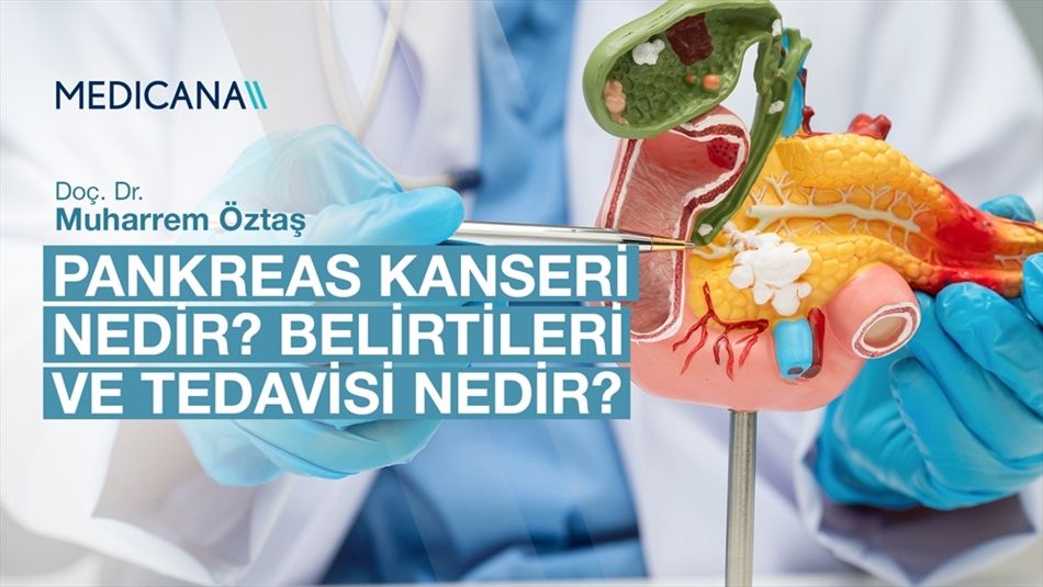 Pankreas Kanseri Nedir? Belirtileri ve Tedavisi Nedir?