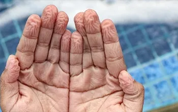 Parmaklar suda neden buruşur? Suda ellerin buruşması zararlı mı?