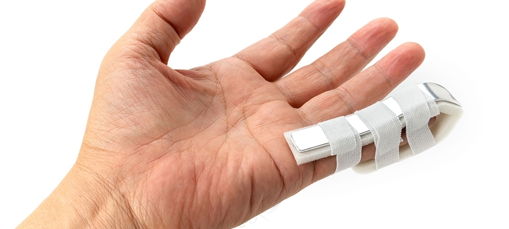 Parmak kırılması nasıl anlaşılır? Parmak kırılması kaç günde iyileşir?