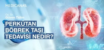 Perkütan Böbrek Taşı Tedavisi Nedir?