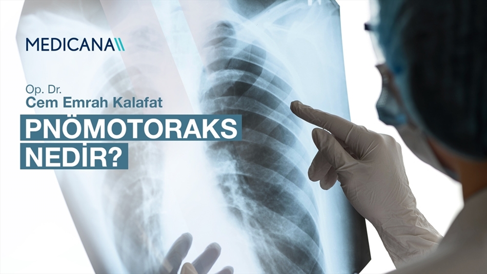 Pnömotoraks Nedir?