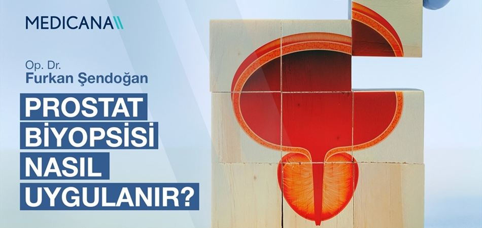 Prostat Biyopsisi Nasıl Uygulanır?