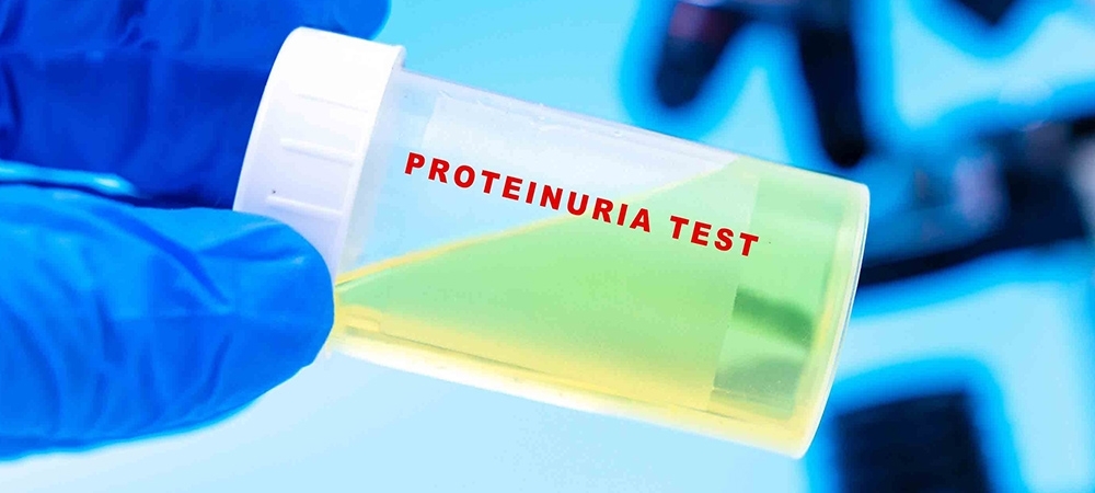 Protein kaçağı nedir? Protein kaçağı neyin belirtisidir?