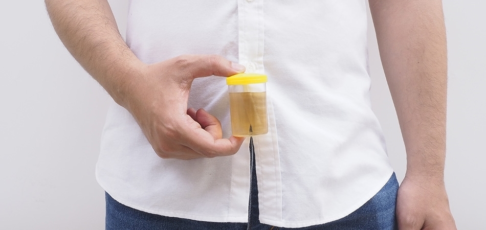 Proteinüri nedir, hangi hastalıkların belirtisi olabilir?