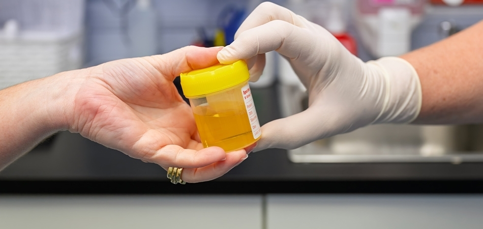 Proteinüri ne demek? Protein yüksekliğinin belirtileri nelerdir?