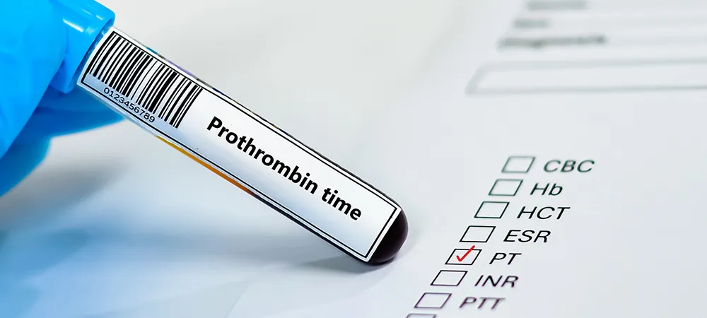 Protrombin nedir? Protrombin ne işe yarar? Protrombin nedir? Protrombin ne işe yarar?
