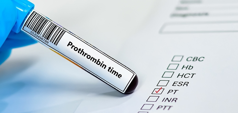 Protrombin nedir? Protrombin ne işe yarar?
