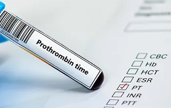 Protrombin nedir? Protrombin ne işe yarar?