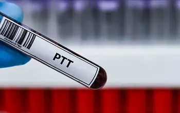 PTT testi: Kanın pıhtılaşma yeteneği nasıl ölçülür?