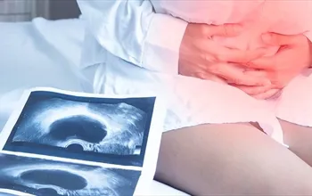 Rahim filmi nasıl çekilir? Rahim filmi ağrılı bir işlem midir?