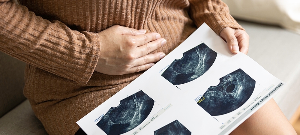 Adet (regl) döneminde hamile kalınır mı? Adetliyken hamile kalma belirtileri nelerdir?