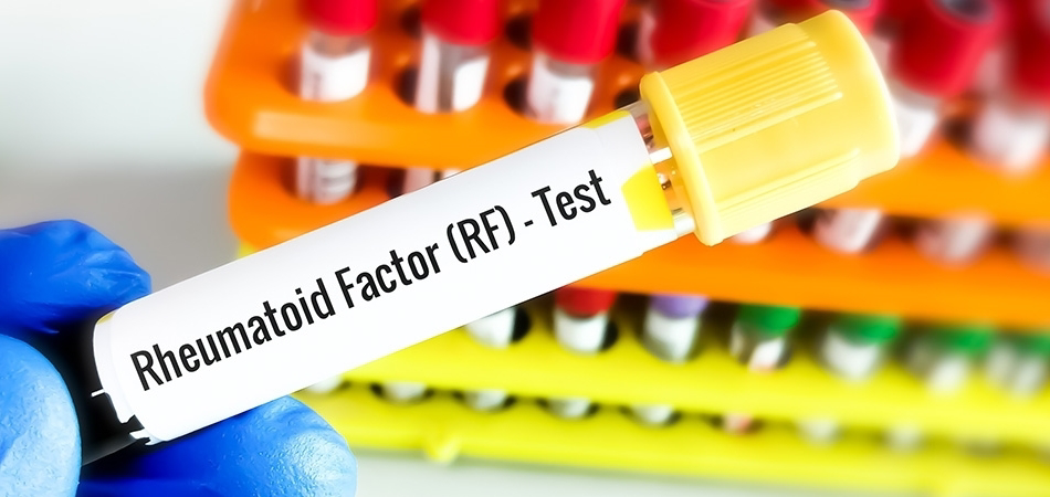 Romatoid faktör nedir: Ne zaman istenir ve sonuçlar nasıl yorumlanır?