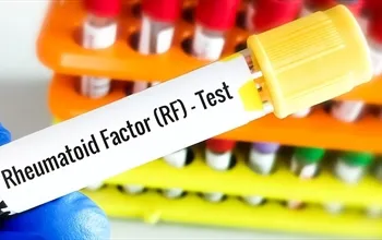 Romatoid faktör nedir: Ne zaman istenir ve sonuçlar nasıl yorumlanır?