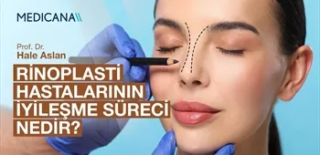 Rinoplasti Hastalarının İyileşme Süreci Nedir?