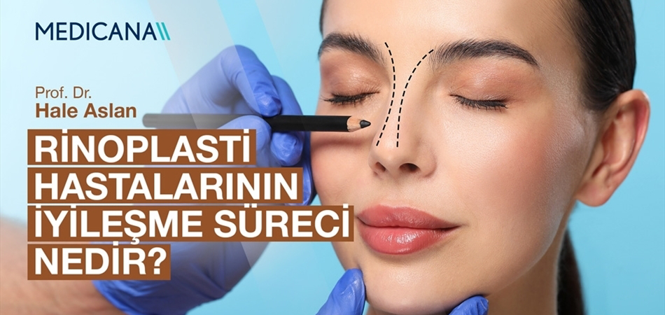 Rinoplasti Hastalarının İyileşme Süreci Nedir?