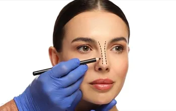 Rinoplasti nedir? Rinoplasti ameliyatı nasıl yapılır?