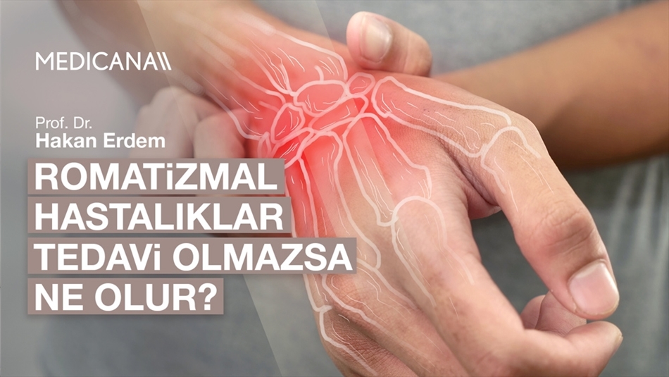 Romatizmal Hastalıklar Tedavi Olmazsa Ne Olur?