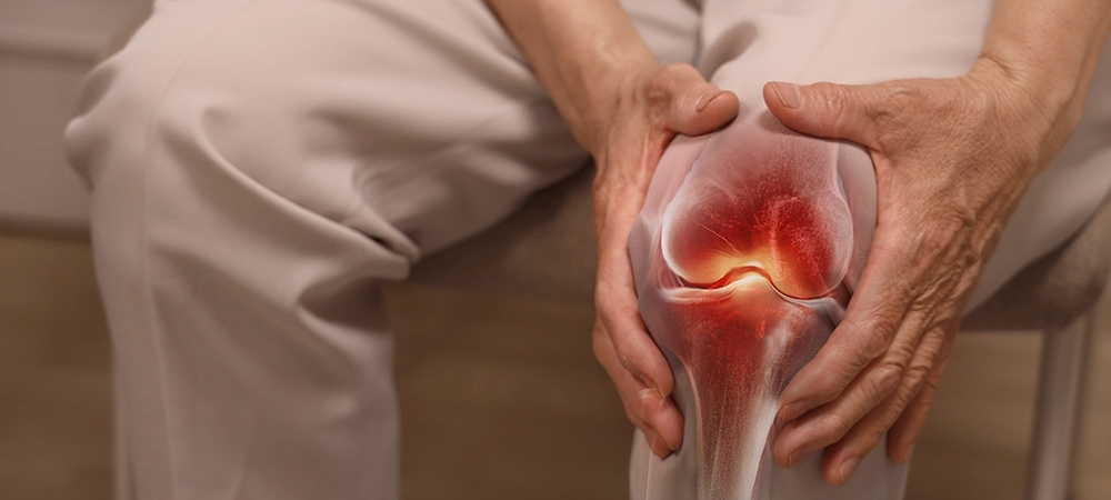 Romatoid artrit nedir? Romatoid artritin belirtileri neler?