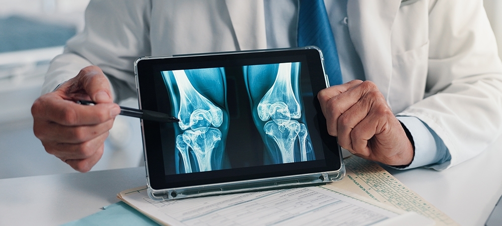 Röntgen nedir? Röntgen ne işe yarar?