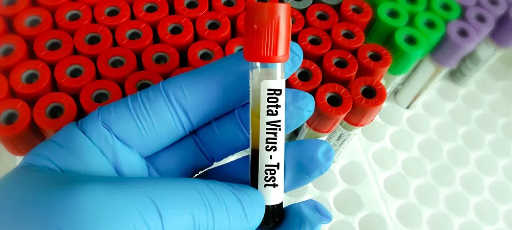 Rota virüsü belirtileri nelerdir? Rota virüsünün geçtiğini nasıl anlarız? Rota virüsü belirtileri nelerdir? Rota virüsünün geçtiğini nasıl anlarız?