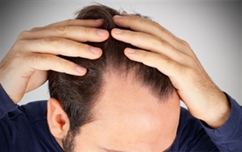 Stresten Uzak Durmak Saç Dökülmesini Önlüyor