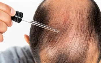 Saç dökülmesine iyi gelen yağlar nelerdir? Saç dökülmesini en hızlı ne durdurur?